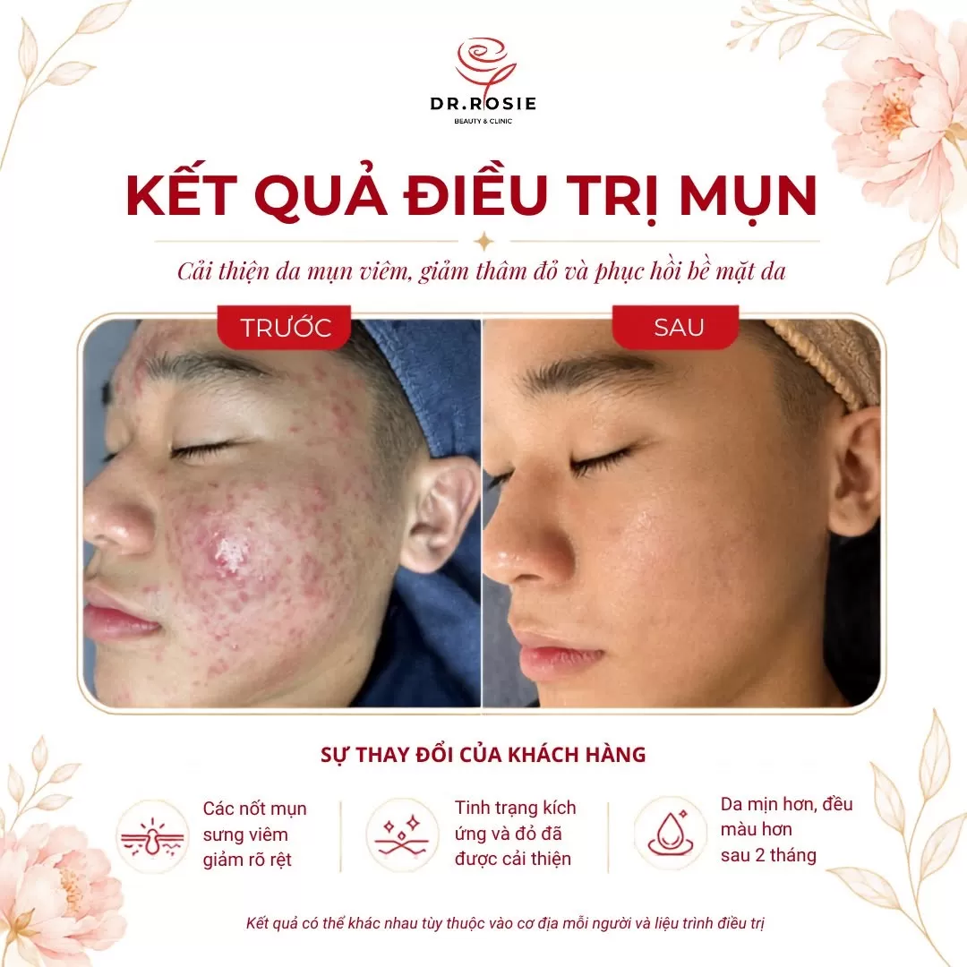 Video triệt lông